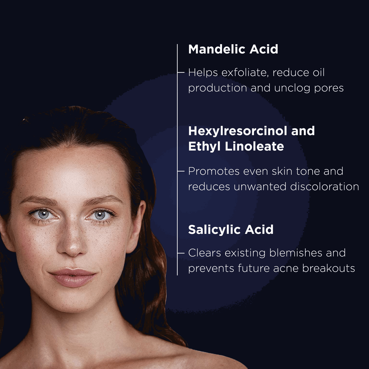 Acne Gel with OmniSome - Medica Group